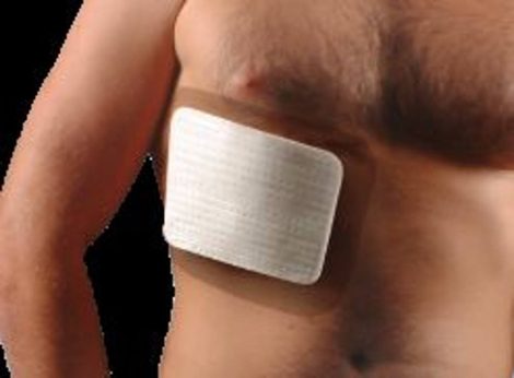 Chrisofix bordasín (L) nagy mellkasi ortézis 17 x 17 cm Chrisofix bordasín (L) nagy mellkasi ortézis 17 x 17 cm