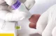 MicroINR véralvadásmérő készülék KTA0001AU MicroINR véralvadásmérő készülék KTA0001AU