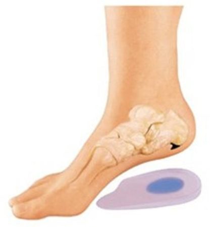 Uriel IT-308 3/4 szilikonos sarokék